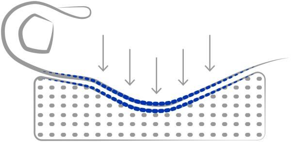 DJO Global AIRCAST® HalguDay® Hallux-Valgus-Korrekturorthese weiß, in vers