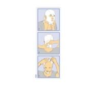 Vorschau: THUASNE CICATREX postoperative Kompressions-Kinnschlinge mit Klettverschluss u. flachen Nähten