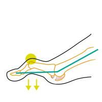 Vorschau: COMPRESSANA TAPE SOX Korrektur/Hilfe bei Hammerzehe wirkt einer Versteifung entgegen