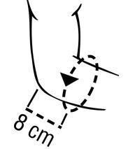 THUASNE Silistab Epi Ellenbogenbandage entlastet die Sehnenansätze mit Silikonpelotten
