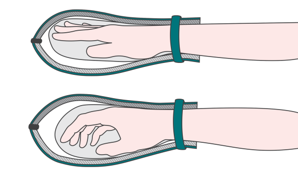 suprima CarePlus Patienten-Schutzhandschuhe, Schützt vor Eigenaggression