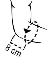 Vorschau: THUASNE Silistab Epi Ellenbogenbandage entlastet die Sehnenansätze mit Silikonpelotten