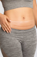 amoena Squares Silikon-Narbenpflaster 260 x 100 mm, 2 Stück