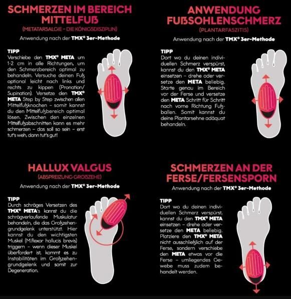 TMX® META Fuß-Trigger Fußtrigger und Fußmobilisator löst einfach und effektiv Verspannungen