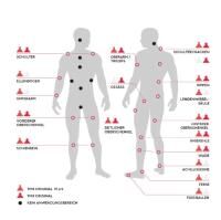 Vorschau: TMX® Original Trigger zur Akupressur von großen Muskelgruppen inkl. Klebepad und App