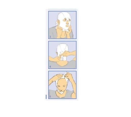 THUASNE CICATREX postoperative Kompressions-Kinnschlinge mit Klettverschluss u. flachen Nähten